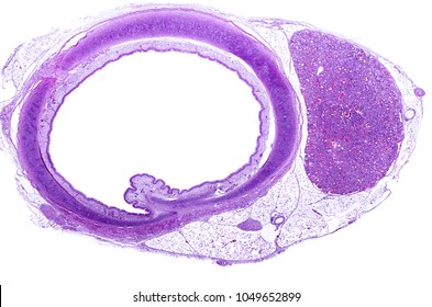 Cross Section Of The Trachea, Showing C-shaped Tracheal Rings Of Hyaline Cartilage. The Tracheal Mucosa Is Located Inside Cartilage. The Right Lobule Of The Thyroid Gland Can Also Be Seen.