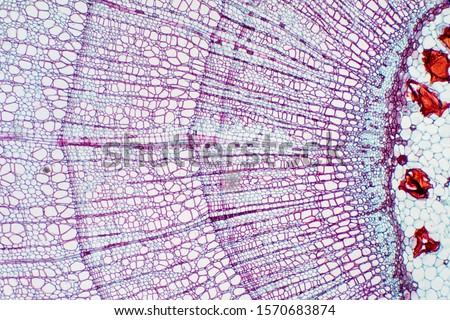 Cross section - Xylem is a type of tissue in vascular plants that transports water and some nutrients. Scientific research. Plant tissue Structure.