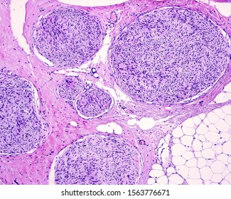 Cross Sectioned Nerve Fiber Fascicles Of An Autonomic Nerve. Each Fascicle Is Surrounded By A Thin Perineurium.