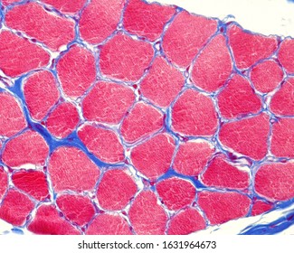 Cross Sectioned Skeletal Striated Muscle Stained With Azan Method. The Myofibrils Of Muscle Fiber Appear Stained In Red Color. The Endomysium Appears As Blue Lines Surrounding The Muscle Fibers.