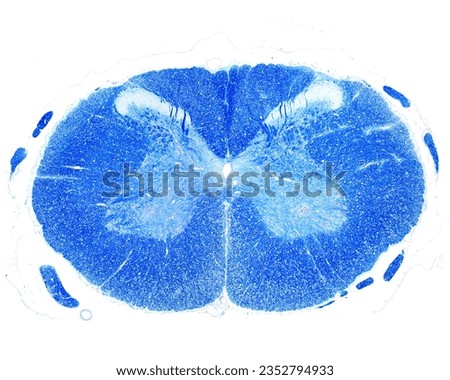 Cross sectioned spinal cord at the cervical level. The central grey matter is surrounded by the white matter, which is stained in blue because it is rich in myelinated fibers. Luxol Fast Blue stain
