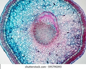 Cross Sections Of  Plant Root Under Microscope View