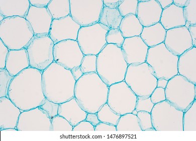 Cross sections of plant stem under microscope view show Structure of Parenchyma Cells for education botany.