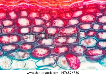 Cross sections of plant stem under microscope view show Structure of Sclerenchyma cells for education botany.