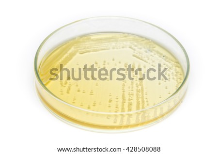 Cross streak of Saccharomyces cerevisiae (baker yeast) growing on yeast extract peptone dextrose agar plate from side view in white background. microbiology laboratory test.