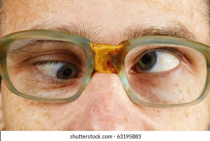 The cross-eyed person in old-fashioned spectacles close up