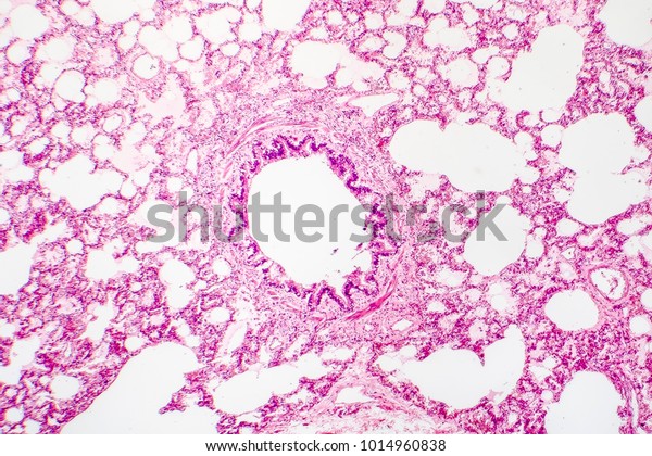 Crosssection Human Lung Tissue Showing Bronchiole Stock Photo (Edit Now ...