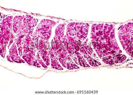 Cross-section of skeletal muscle. Photo under microscope