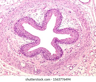 Cross-sectioned rabbit ureter showing from the lumen: transitional epithelium (urothelium), lamina propria, smooth muscle fibers of muscular layer, adventitia, and adipose tissue of retroperitoneum - Shutterstock ID 1563776494