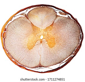 Cross-sectioned spinal cord surrounded by meninges showing, from outside inside, dura mater (thick), subdural space, arachnoid matter (very thin) and subarachnoid space with nerve roots. Silver stain 