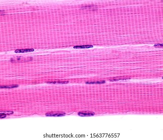 
				Cross-striation of striated skeletal muscle fibers with dark A bands and light I bands. The clear zone in the center of A bands is the H zone. The nuclei are located in the cell periphery