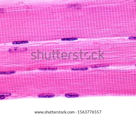 
Cross-striation of striated skeletal muscle fibers with dark A bands and light I bands. The clear zone in the center of A bands is the H zone. The nuclei are located in the cell periphery