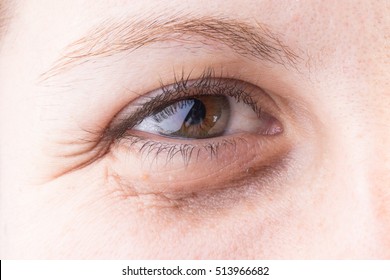 Crow's Feet In Female Eye