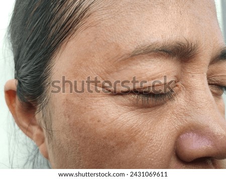Crow's feets with Facial skin problems of freckles, dark spots and wrinkles on the faces of Asain women stressed expression, frowning, Rough skin, Isolated on white background and concept of healthy