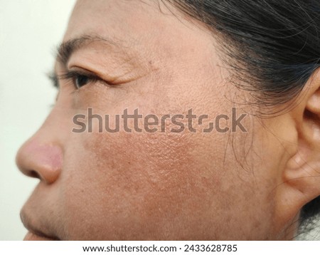 Crow's feets with Facial skin problems of freckles, dark spots and wrinkles on the faces of Asain women stressed expression, frowning, Rough skin, Isolated on white background and concept of healthy