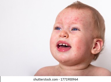 Roseola Hd Stock Images Shutterstock