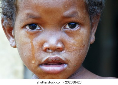 Crying Girl With Tear On Cheek - Poor African Child