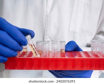 Cryogenic test tube with liquid bacteria inside, test tubes with bacteria in a red stand, scientist takes out one test tub - Powered by Shutterstock