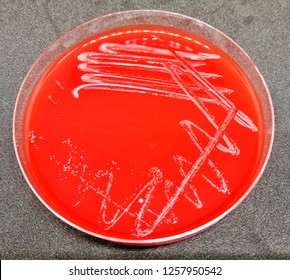 Cryptococcus Images, Stock Photos & Vectors | Shutterstock