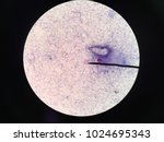 Cryptococcus from stool (oil) ,mAFB