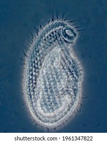 Cryptopharynx, Portrait Of Single, Living Ciliate (protist) Cell (phase Contrast Microscopy)