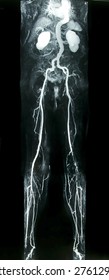 CT Body Angiography