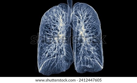 CT Chest or Lung 3d rendering image  showing Trachea and lung in respiratory system.	