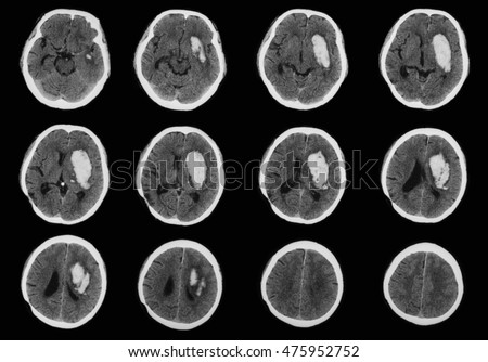 ct scan computed tomography brain brain の写真素材 今すぐ編集