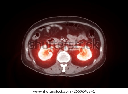 CTA of Aorta and Major Branches:A comprehensive CTA scan showing the aorta and its major branches, providing clear visualization for vascular assessment and diagnosis.