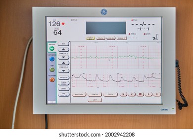 CTG device with monitoring of the state of health of the mother and child during childbirth in the hospital. Cardiotocograph device for measuring the baby pulse - Russia, Moscow Region, June 23, 2021