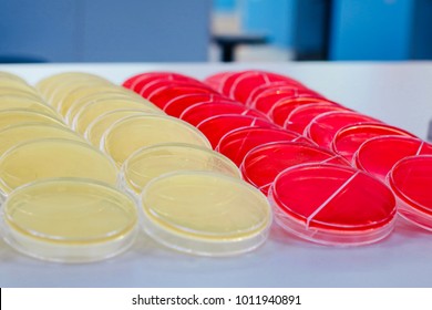 Culture Medium Agar Plate Stock Photo 1011940891 | Shutterstock