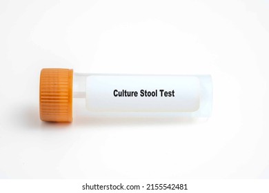 Culture Stool Test In Lab