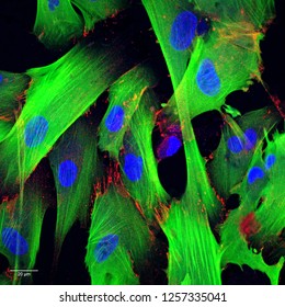 cultured human cells stained with fluorescent dyes (cardiac myofibroblasts stained for calponin in green, N-cadherin in red, and in blue for DNA)