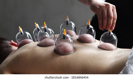 Cup massage close up. Banks for massage on the man's back. Massage with vacuum cups. - Shutterstock ID 1816846454