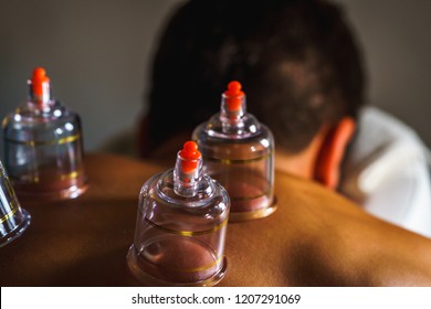 Cupping Glass Therapy