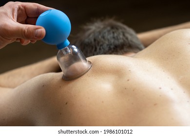 Cupping Massage Treatment On The Back Of A Man