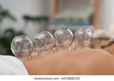 Cupping therapy. Closeup view of woman with glass cups on her back indoors - Powered by Shutterstock