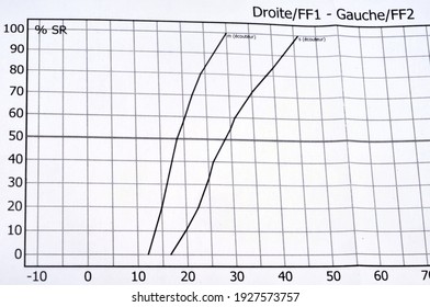 Curves Of A Hearing Test In Close-up 