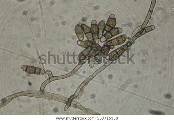 Curvularia Spores Stock Photo (Edit Now) 559716358