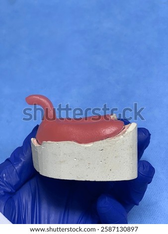 Custom Tray for Complete Denture Impression