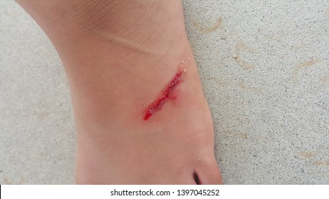 Cut Feet Little Blood Stock Photo 1397045252 | Shutterstock