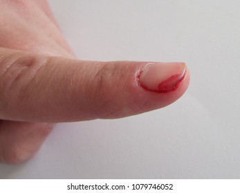 Hand Cut Blood Stock Images, Royalty-Free Images & Vectors | Shutterstock