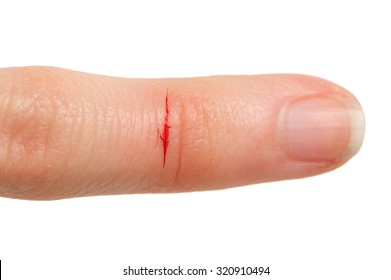 Cut Finger with Blood
