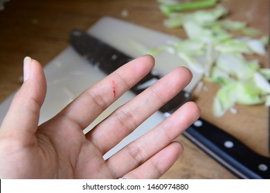 A Cut Of Finger In The Kitchen