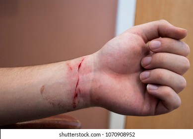 Cut my Wrist  - Shutterstock ID 1070908952