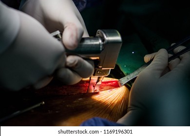 Cut Sternal Bone Open Chest Stock Photo 1169196301 | Shutterstock