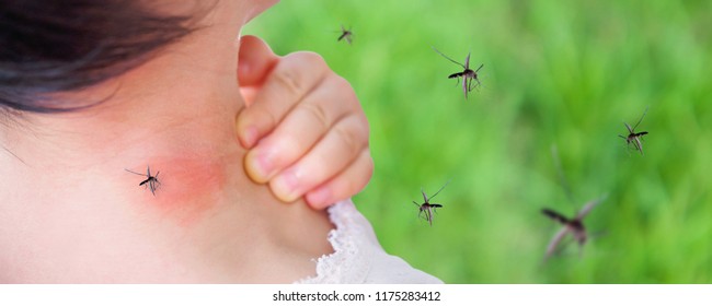 Cute Asian Baby Girl Has Rash And Allergy On Neck Skin From Mosquito Bite And Sucking Blood While Playing Outdoor