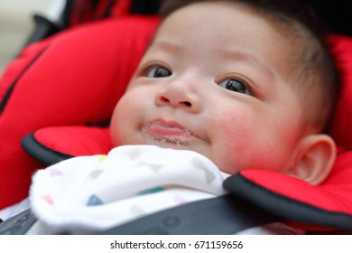 Cute Baby Boy Happy Playful Bubbles Saliva Drool On Child Mouth With Allergic Rash On Kid Chubby Cheeks