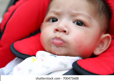 Cute Baby Boy Happy Playful Bubbles Saliva Drool On Child Mouth With Allergic Rash On Kid Chubby Cheeks