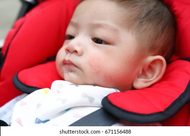 Cute Baby Boy Playful Bubbles Saliva Drool On Child Mouth With Allergic Rash On Kid Chubby Cheeks